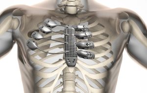 5 3D Printing Materials Commonly Used in the Medical Industry